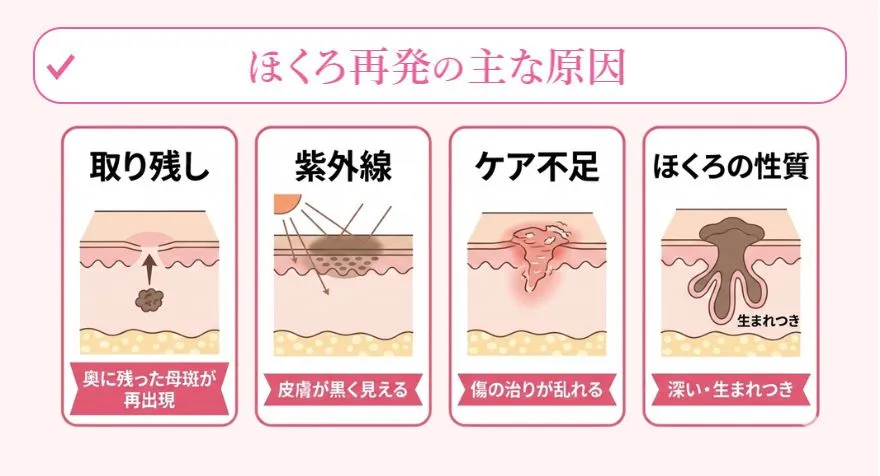 ほくろ除去をしたのにほくろが再発する原因