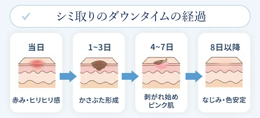 シミ取りのダウンタイムの経過