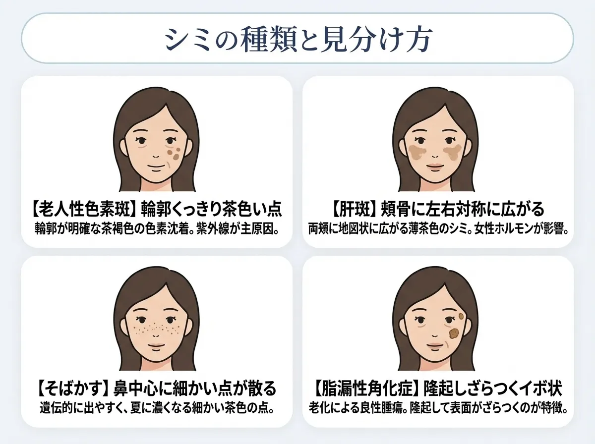 30代以降に現れる代表的なシミの特徴
